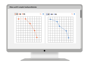 Résultat d'un bilan auditif réalisé par audioprothésiste